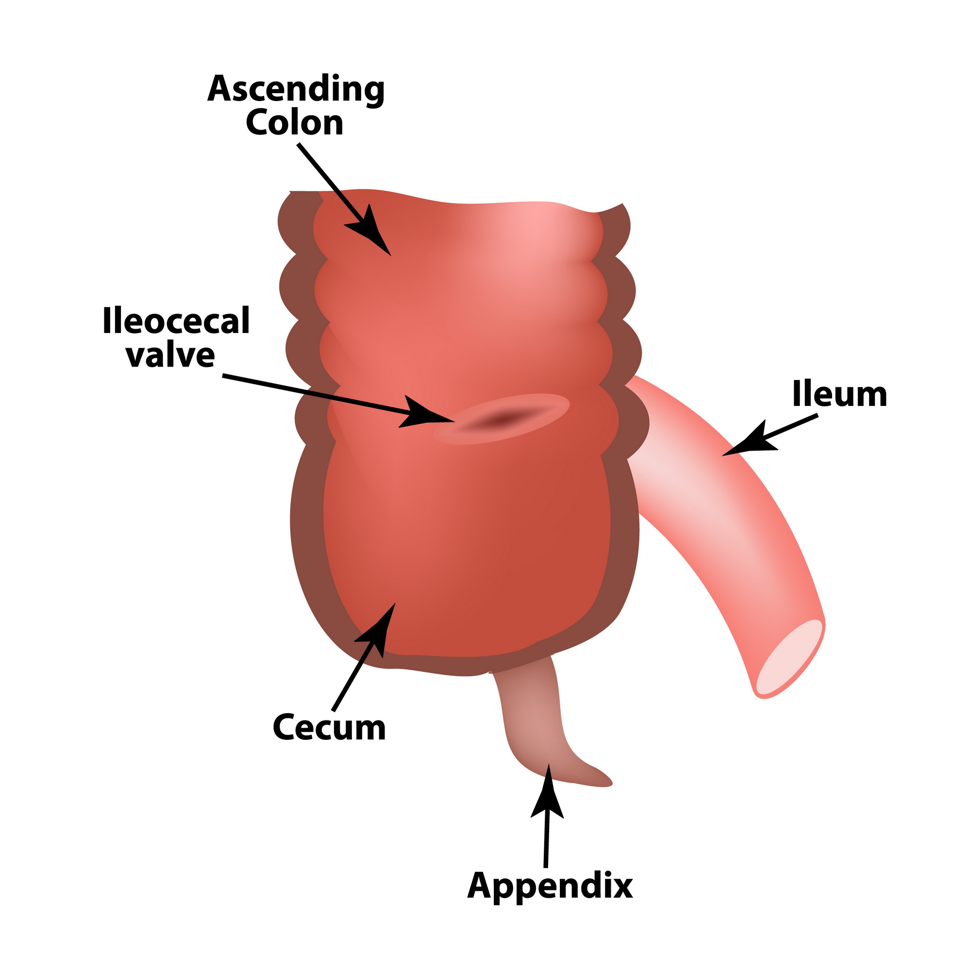 Ileocecal angle. Ileocecal valve. Bauginiev s damper. The ileum, the Cecum, the Apendix. Colon. Infographics. Vector illustration on isolated background